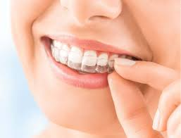 Enhance Your Smile: Discovering Cosmetic Dentistry on the Gold Coast