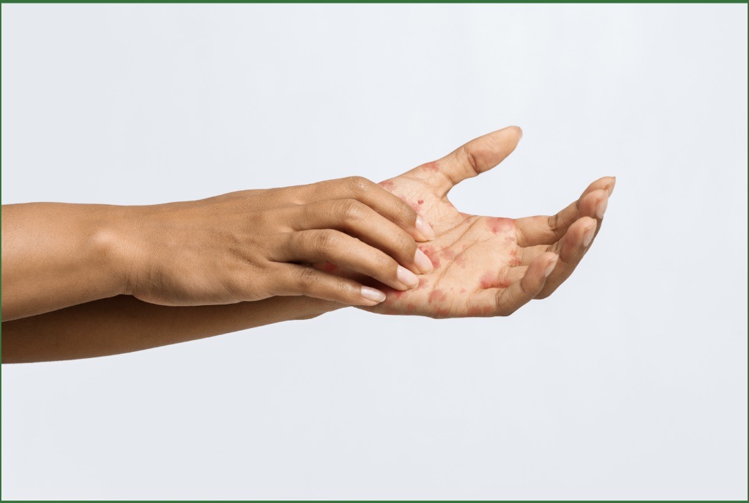 Reducing Skin Irritation in Daily Work Environments