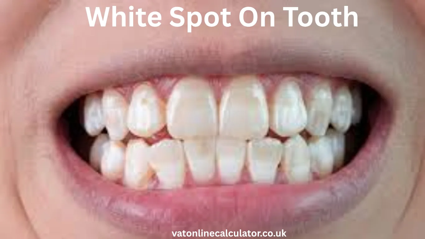 White Spot On Tooth
